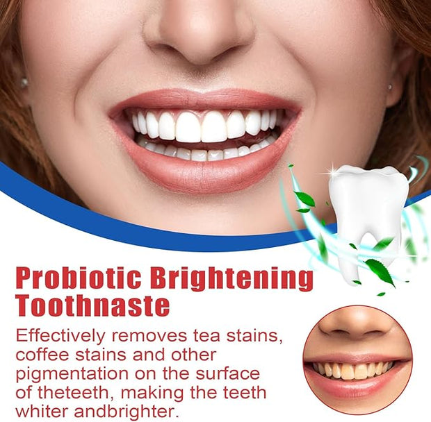 معجون بروبيوتيك SP-4 للتبييض الفائق 