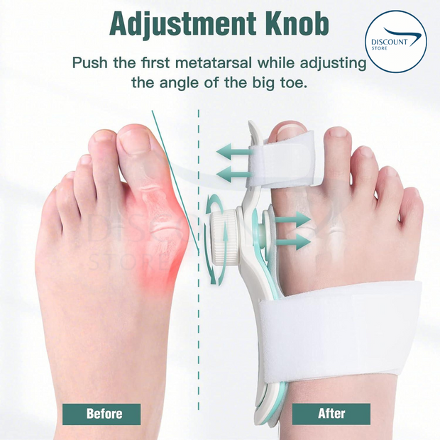 مصحح إصبع القدم لتخفيف الألم - (مستورد)