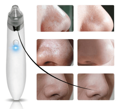 BLACKHEAD REMOVER